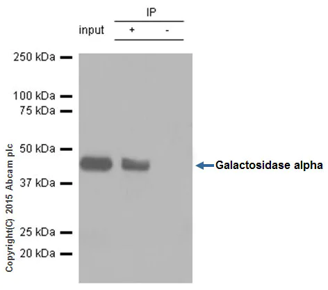 Immunoprecipitation - Anti-Galactosidase alpha antibody [EP5828(2)] (AB168341)