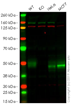 Western blot - Anti-Galactosidase alpha antibody [EP5828(2)] (AB168341)
