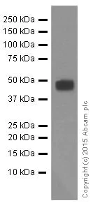 Western blot - Anti-Galactosidase alpha antibody [EP5828(2)] (AB168341)