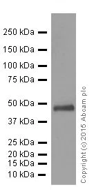 Western blot - Anti-Galactosidase alpha antibody [EP5828(2)] (AB168341)