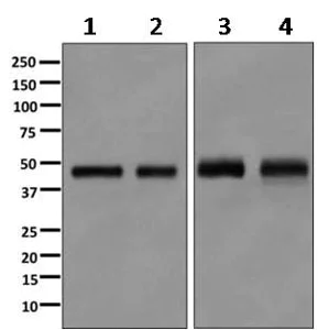 Western blot - Anti-Galactosidase alpha antibody [EP5828(2)] (AB168341)