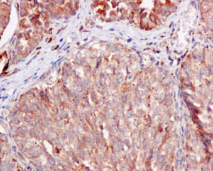 Immunohistochemistry (Formalin/PFA-fixed paraffin-embedded sections) - Anti-Galactosidase alpha antibody [EP5828(2)] - BSA and Azide free (AB215258)