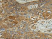 Immunohistochemistry (Formalin/PFA-fixed paraffin-embedded sections) - Anti-Galactoside 2-alpha-L-fucosyltransferase 1 antibody (AB198712)