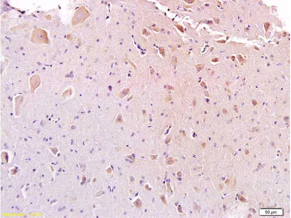 Immunohistochemistry (Formalin/PFA-fixed paraffin-embedded sections) - Anti-Galanin antibody (AB216399)