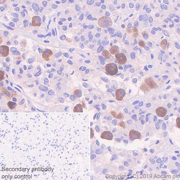Immunohistochemistry (Formalin/PFA-fixed paraffin-embedded sections) - Anti-Galanin antibody [EPR22496-254] (AB255295)
