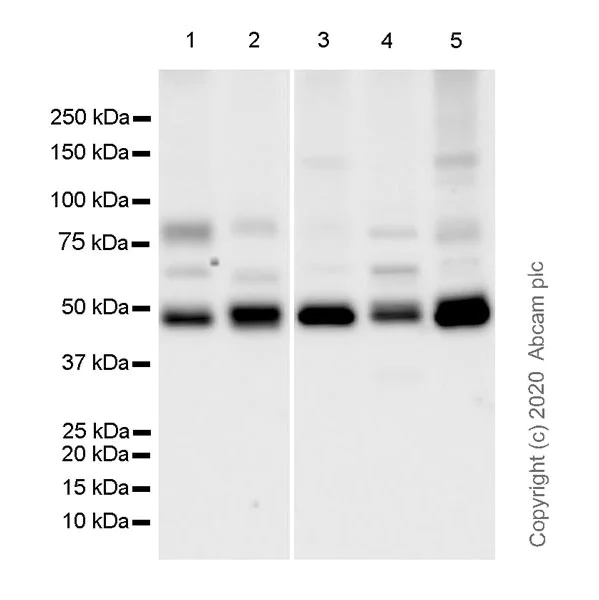 Western blot - Anti-GALC antibody [EPR23598-126] (AB240638)