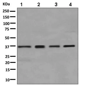 Western blot - Anti-GALE antibody [EPR11088(B)] (AB155997)