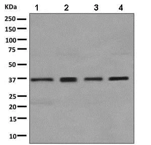 Western blot - Anti-GALE antibody [EPR11088(B)] - BSA and Azide free (AB249240)
