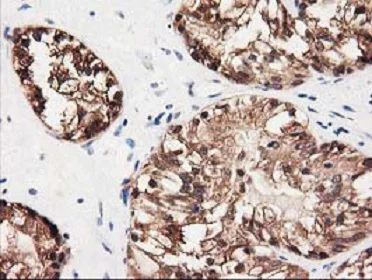 Immunohistochemistry (Formalin/PFA-fixed paraffin-embedded sections) - Anti-GALE antibody [OTI1C4] (AB118033)