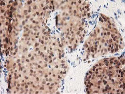 Immunohistochemistry (Formalin/PFA-fixed paraffin-embedded sections) - Anti-GALE antibody [OTI1C4] (AB118033)