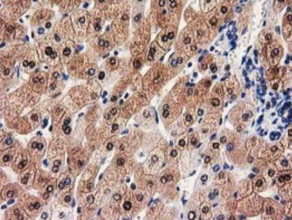 Immunohistochemistry (Formalin/PFA-fixed paraffin-embedded sections) - Anti-GALE antibody [OTI1C4] (AB118033)