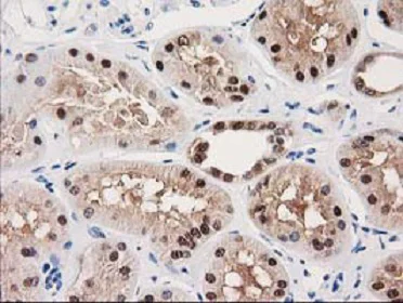 Immunohistochemistry (Formalin/PFA-fixed paraffin-embedded sections) - Anti-GALE antibody [OTI1C4] (AB118033)
