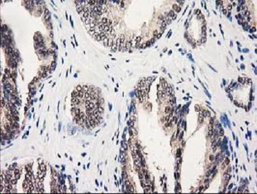 Immunohistochemistry (Formalin/PFA-fixed paraffin-embedded sections) - Anti-GALE antibody [OTI1C4] (AB118033)