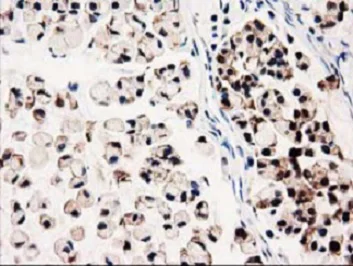 Immunohistochemistry (Formalin/PFA-fixed paraffin-embedded sections) - Anti-GALE antibody [OTI1C4] (AB118033)