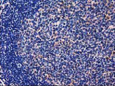 Immunohistochemistry (Formalin/PFA-fixed paraffin-embedded sections) - Anti-GALE antibody [OTI1C4] (AB118033)