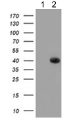 Western blot - Anti-GALE antibody [OTI1C4] (AB118033)