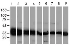 Western blot - Anti-GALE antibody [OTI1C4] (AB118033)