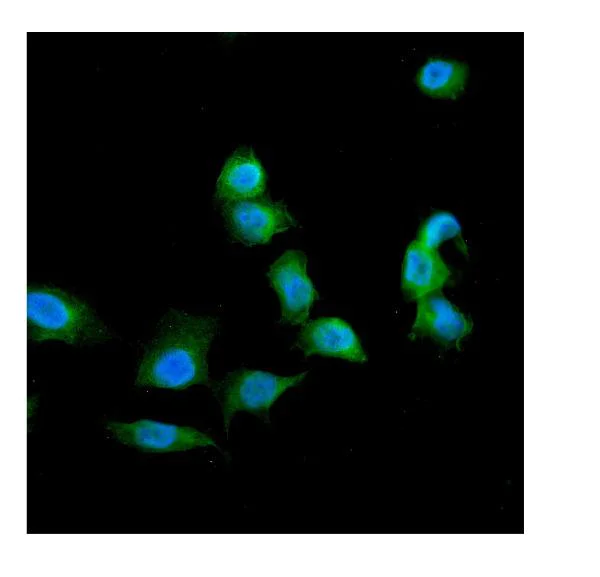 Immunocytochemistry - Anti-Galectin 1 antibody (AB112525)