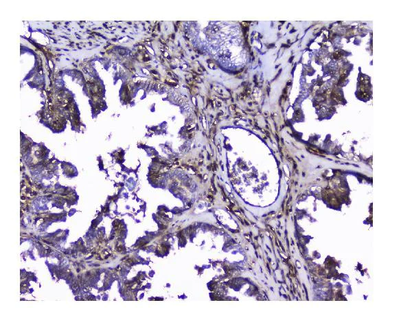 Immunohistochemistry (Formalin/PFA-fixed paraffin-embedded sections) - Anti-Galectin 1 antibody (AB112525)
