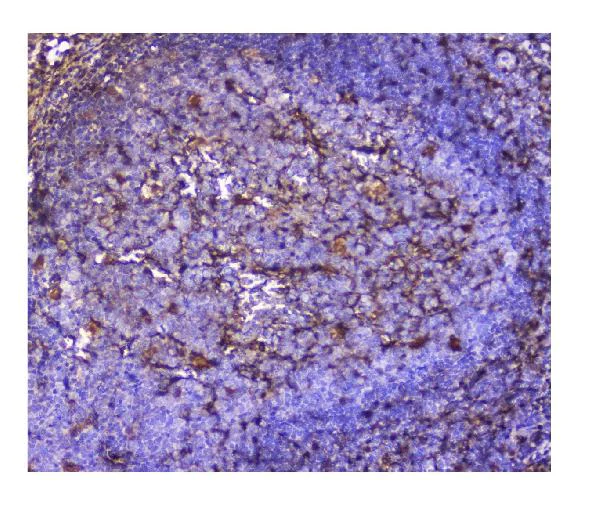 Immunohistochemistry (Formalin/PFA-fixed paraffin-embedded sections) - Anti-Galectin 1 antibody (AB112525)