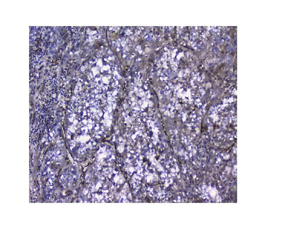 Immunohistochemistry (Formalin/PFA-fixed paraffin-embedded sections) - Anti-Galectin 1 antibody (AB112525)