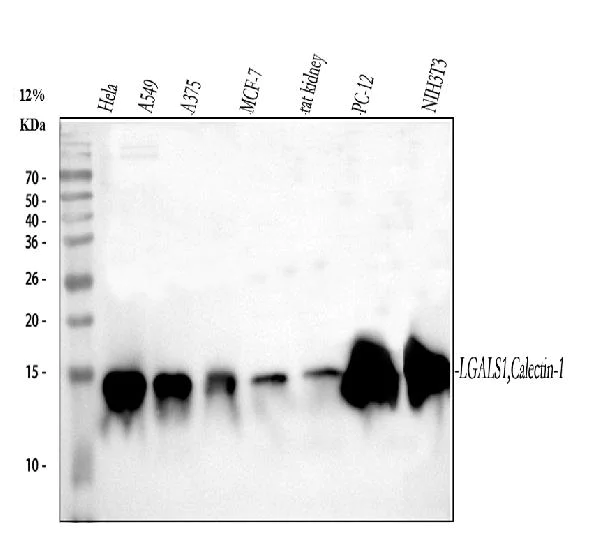 Western blot - Anti-Galectin 1 antibody (AB112525)