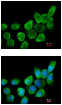 Immunocytochemistry/ Immunofluorescence - Anti-Galectin 1 antibody (AB154351)