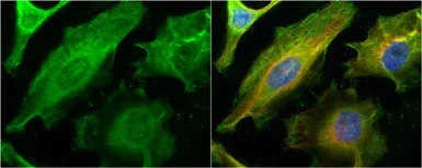 Immunocytochemistry/ Immunofluorescence - Anti-Galectin 1 antibody (AB154351)
