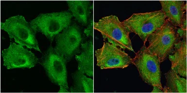 Immunocytochemistry/ Immunofluorescence - Anti-Galectin 1 antibody (AB154351)
