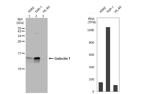 Western blot - Anti-Galectin 1 antibody (AB154351)