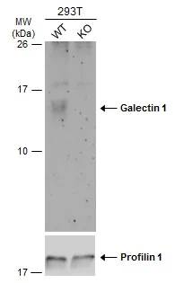Western blot - Anti-Galectin 1 antibody (AB154351)