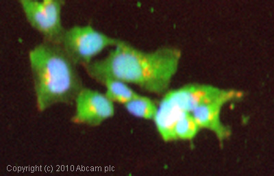 Immunocytochemistry/ Immunofluorescence - Anti-Galectin 1 antibody (AB25138)