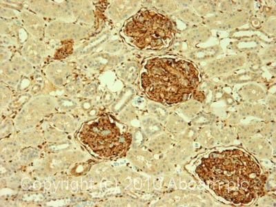 Immunohistochemistry (Formalin/PFA-fixed paraffin-embedded sections) - Anti-Galectin 1 antibody (AB25138)