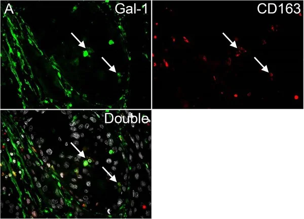 Immunohistochemistry (Formalin/PFA-fixed paraffin-embedded sections) - Anti-Galectin 1 antibody (AB25138)