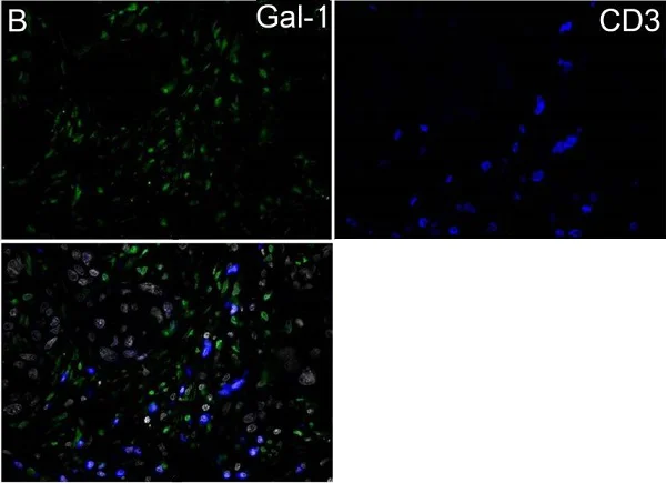 Immunohistochemistry (Formalin/PFA-fixed paraffin-embedded sections) - Anti-Galectin 1 antibody (AB25138)