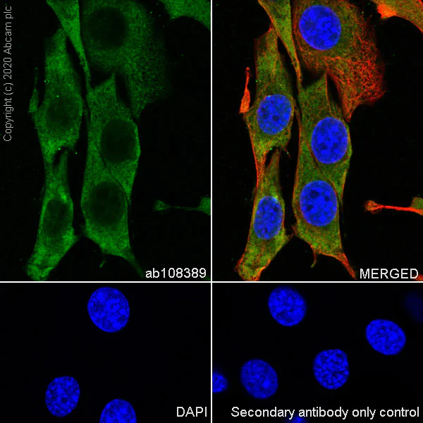 Immunocytochemistry/ Immunofluorescence - Anti-Galectin 1 antibody [EPR3205] (AB108389)