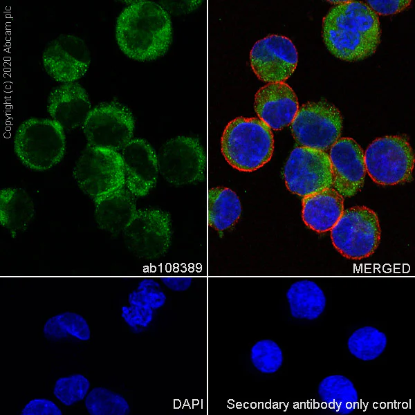 Immunocytochemistry/ Immunofluorescence - Anti-Galectin 1 antibody [EPR3205] (AB108389)