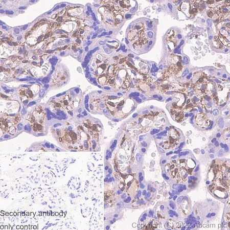 Immunohistochemistry (Formalin/PFA-fixed paraffin-embedded sections) - Anti-Galectin 1 antibody [EPR3205] - BSA and Azide free (AB271876)