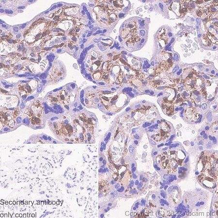 Immunohistochemistry (Formalin/PFA-fixed paraffin-embedded sections) - Anti-Galectin 1 antibody [EPR3205] - Low endotoxin, Azide free (AB225540), expandable thumbnail