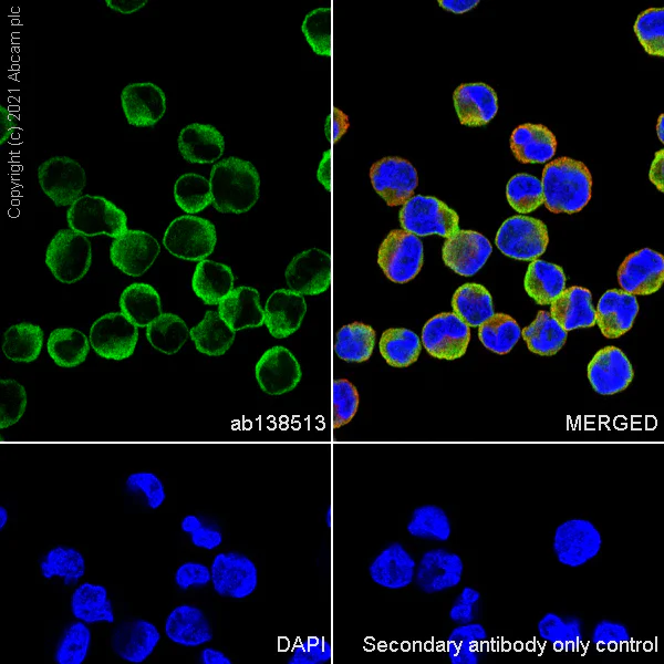 Immunocytochemistry/ Immunofluorescence - Anti-Galectin 1 antibody [EPR3206(2)] (AB138513)