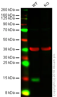 Western blot - Anti-Galectin 1 antibody [EPR3206(2)] (AB138513)