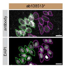 Immunocytochemistry/ Immunofluorescence - Anti-Galectin 1 antibody [EPR3206(2)] - BSA and Azide free (AB240111)