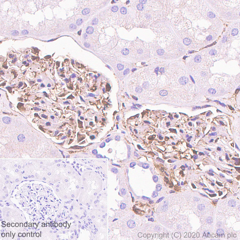 Immunohistochemistry (Formalin/PFA-fixed paraffin-embedded sections) - Anti-Galectin 1 antibody [EPR3206(2)] - BSA and Azide free (AB240111)