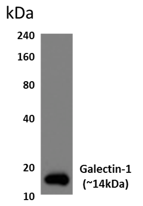 Western blot - Anti-Galectin 1 antibody [RM0081-9J26] (AB86056)
