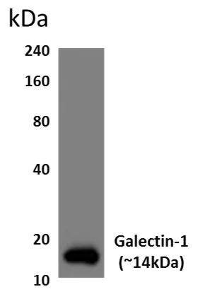 Western blot - Anti-Galectin 1 antibody [RM0081-9J26] (AB86056)