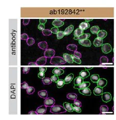 Immunocytochemistry/ Immunofluorescence - Anti-Galectin 1 antibody [SP247] - BSA and Azide free (AB240972)