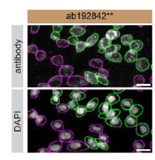 Immunocytochemistry/ Immunofluorescence - Anti-Galectin 1 antibody [SP247] - C-terminal (AB192842)