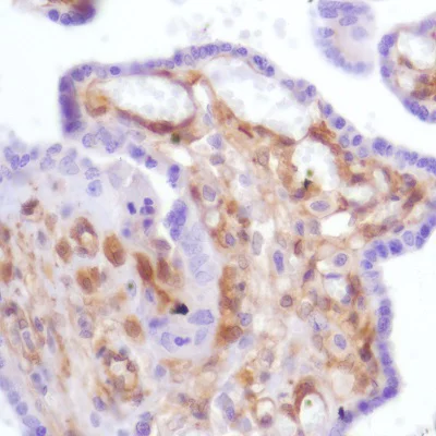 Immunohistochemistry (Formalin/PFA-fixed paraffin-embedded sections) - Anti-Galectin 1 antibody [SP247] - C-terminal (AB192842)
