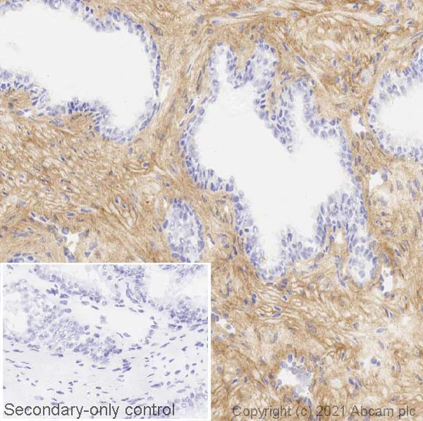 Immunohistochemistry (Frozen sections) - Anti-Galectin 1 antibody [SP247] - C-terminal (AB192842)