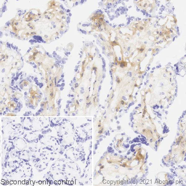 Immunohistochemistry (Frozen sections) - Anti-Galectin 1 antibody [SP247] - C-terminal (AB192842)